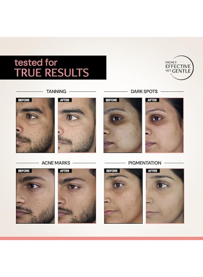 Deconstruct 5% Niacinamide Serum + 2% Alpha Arbutin Clearing Serum| Clinically Tested| Reduces Dark Spots, Pigmentation, Acne Marks & Tanning |4-in-1 Multi-Benefit |Non-Irritating | 20ml - Image 4